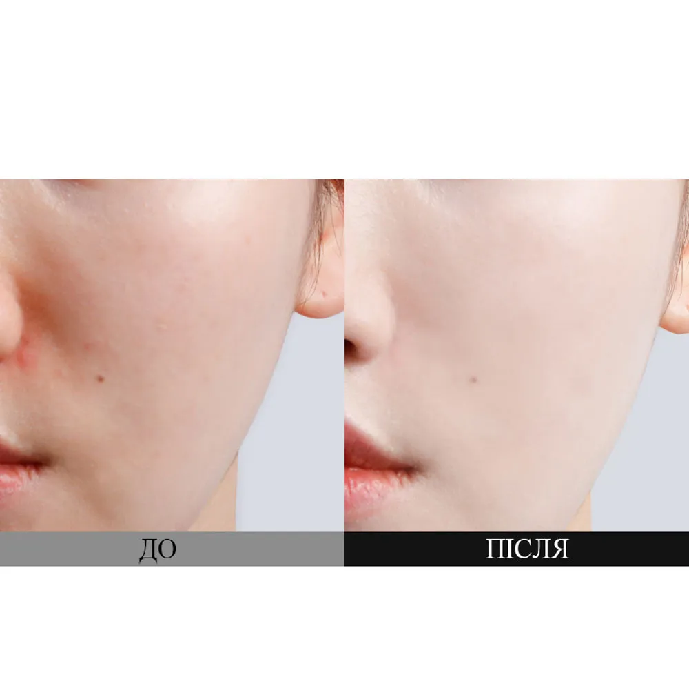 Сонцезахисний освітлювальний крем з пробіотиками Dr.Ceuracle Pro Balance Biotics Clear Up Sun SPF50+ PA++++ 2 мл Саше (Тестер)